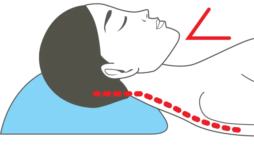 Poor alignment illustration